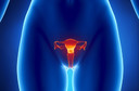 Cistos vaginais - conceito, causas, características clínicas, diagnóstico e tratamento