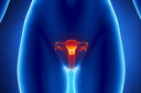 Prolapso uterino: o que é? Quais as causas e os sintomas? Como é diagnosticado e tratado?
