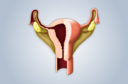 Sinéquias uterinas: o que é isso?